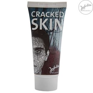 Picture of Cracked skin